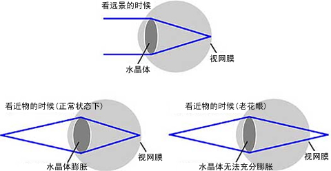 人什么時(shí)候得老花眼