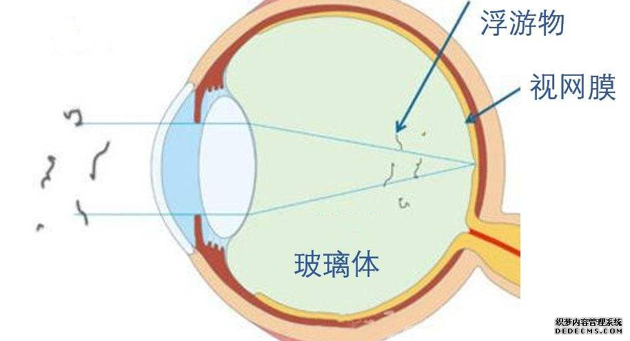 什么叫玻璃體?檢查玻璃體有什么臨床意義?